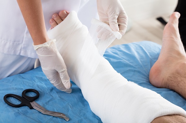 Coping with a Cast and Tips for Your Cast Care - Chester County ...